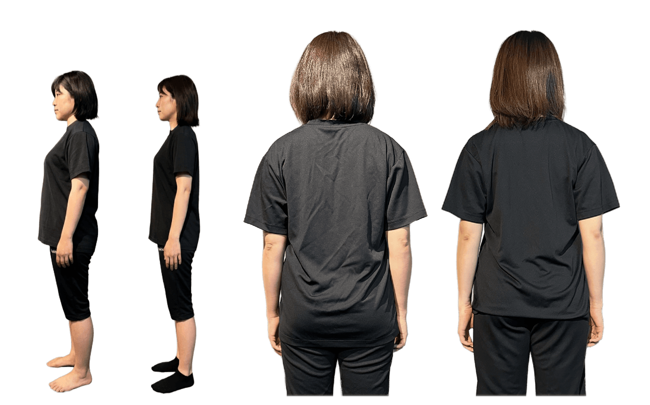 ビフォーアフター写真（女性・ダイエット 3ヶ月コース）